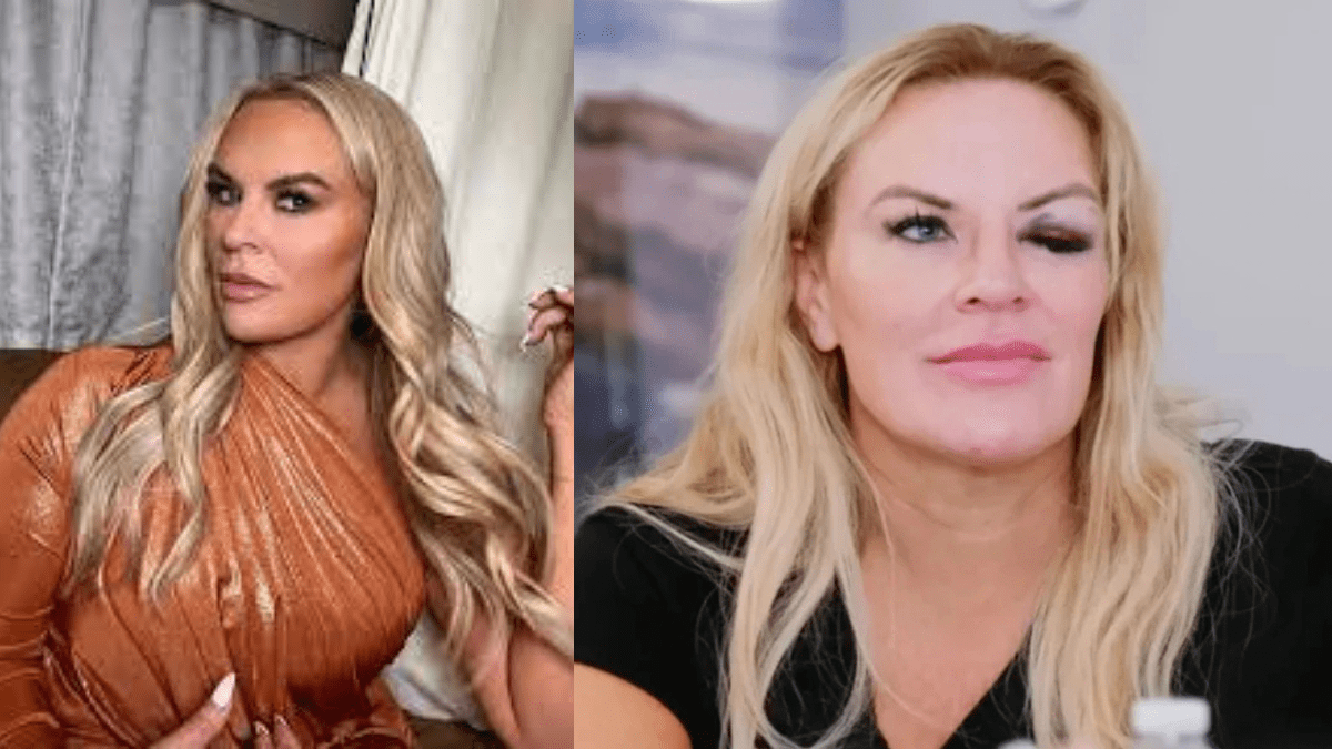 Heather Gay Finally Uncovers the Backstory Behind Her Black Eye ; Truth Inside