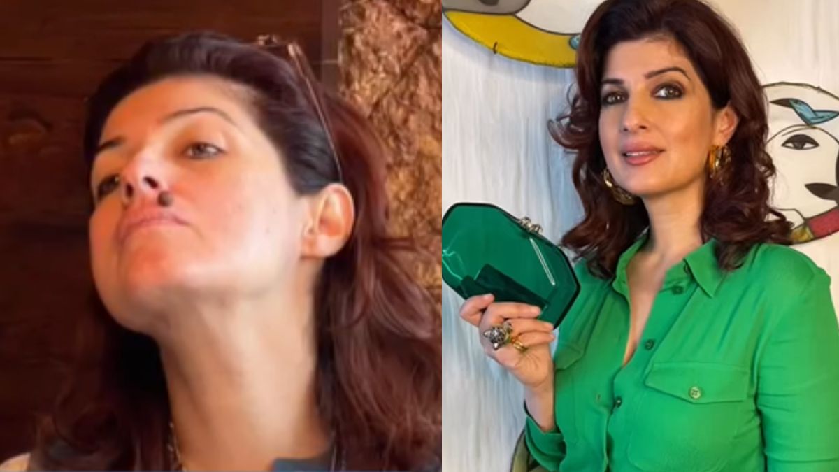 Twinkle Khanna Shares Picture Of A New Mole On Her Face; Leaves Fans In Confusion