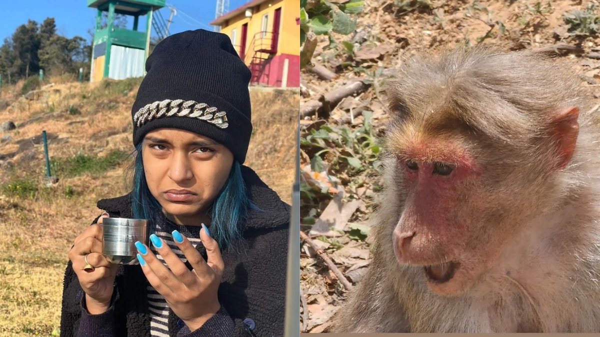 Monkey Bites ‘Sumbul Toqueer’ While Visiting Ooty, Shares Wound Pictures From Hospital: Checkout!