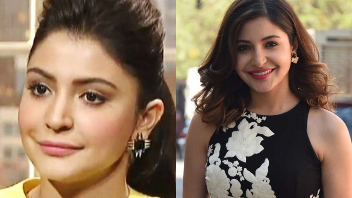 When Anushka Sharma Justified Her Lip Enhancement Surgery Said “I Have Nothing To Hide…”