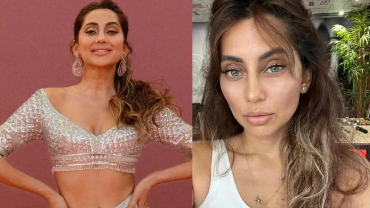 ‘Tried Injecting But…’, Anusha Dandekar Reveals Failing A Lip Surgery!