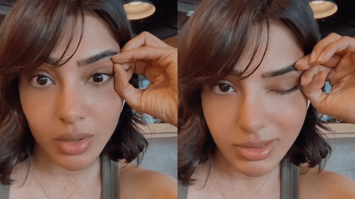 Samantha Ruth Prabhu Says Myositis Treatment Gave Her Pigmentation; ‘Steroids Messed Up Skin’